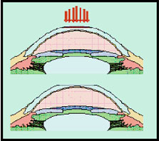 Apollo Specialty Hospital, Apollo Specialty Cancer Hospital